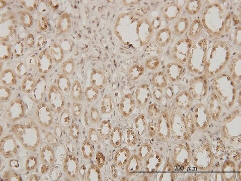 Monoclonal Anti-EXOSC3 antibody produced in mouse clone 5C3, purified immunoglobulin, buffered aqueous solution