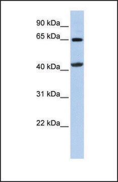 Anti-GATM antibody produced in rabbit affinity isolated antibody