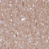 Anti-SLC6A1 antibody produced in rabbit Prestige Antibodies&#174; Powered by Atlas Antibodies, affinity isolated antibody, buffered aqueous glycerol solution