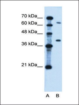 Anti-LRRC26 antibody produced in rabbit affinity isolated antibody