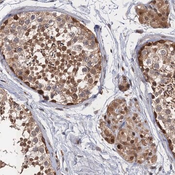 Anti-NEK8 antibody produced in rabbit Prestige Antibodies&#174; Powered by Atlas Antibodies, affinity isolated antibody, buffered aqueous glycerol solution