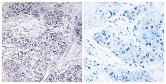 Anti-CEBPG antibody produced in rabbit affinity isolated antibody