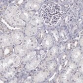 Anti-COX2 antibody produced in rabbit Prestige Antibodies&#174; Powered by Atlas Antibodies, affinity isolated antibody, buffered aqueous glycerol solution