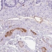 Anti-IGF1 antibody produced in rabbit Prestige Antibodies&#174; Powered by Atlas Antibodies, affinity isolated antibody, buffered aqueous glycerol solution