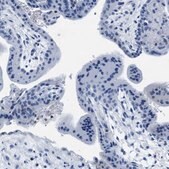 Anti-MMP8 antibody produced in rabbit Prestige Antibodies&#174; Powered by Atlas Antibodies, affinity isolated antibody, buffered aqueous glycerol solution, Ab2