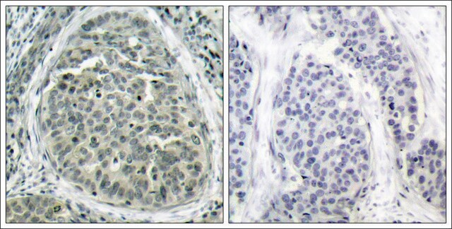 Anti-phospho-CTNNB1 (pSer37) antibody produced in rabbit affinity isolated antibody