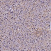 Anti-CYP2D6 antibody produced in rabbit Prestige Antibodies&#174; Powered by Atlas Antibodies, affinity isolated antibody, buffered aqueous glycerol solution