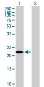 Anti-TSC22D3 antibody produced in mouse purified immunoglobulin, buffered aqueous solution