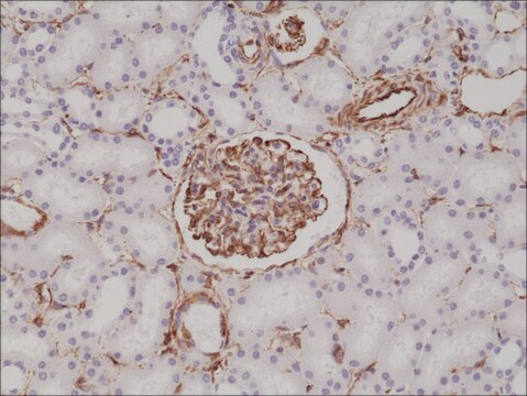 Anti-Vimentin antibody, Rabbit Monoclonal recombinant, expressed in HEK 293 cells, clone RM289, purified immunoglobulin