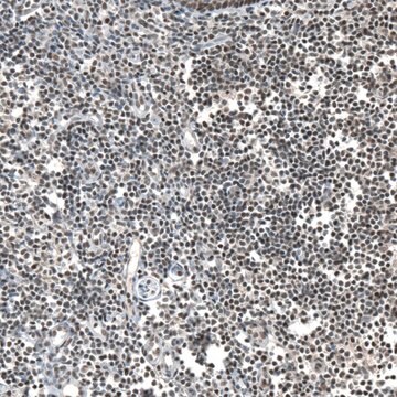 Anti-JADE2 antibody produced in rabbit Prestige Antibodies&#174; Powered by Atlas Antibodies, affinity isolated antibody, buffered aqueous glycerol solution