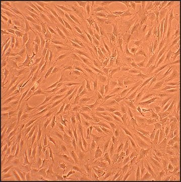 Human Chondrocytes - Rheumatoid Arthritis: HC-RA, adult