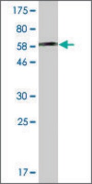 ANTI-AHCY antibody produced in mouse clone 2F11-1D10, ascites fluid