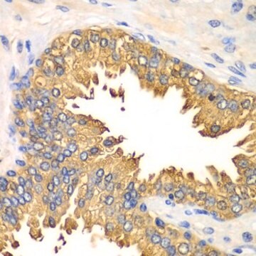 Anti-RIG-I/DDX58 antibody produced in rabbit