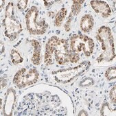 Anti-CLPP antibody produced in rabbit Prestige Antibodies&#174; Powered by Atlas Antibodies, affinity isolated antibody, buffered aqueous glycerol solution