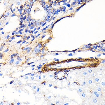 Anti-&#945;-Smooth Muscle Actin (ACTA2) Antibody, clone 2V4L9, Rabbit Monoclonal