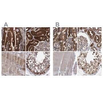 Anti-GLOD4 antibody produced in rabbit Prestige Antibodies&#174; Powered by Atlas Antibodies, affinity isolated antibody, buffered aqueous glycerol solution, Ab2