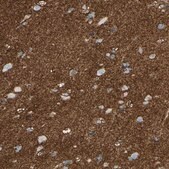 Anti-SLC1A2 antibody produced in rabbit Prestige Antibodies&#174; Powered by Atlas Antibodies, affinity isolated antibody, buffered aqueous glycerol solution