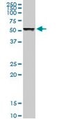Anti-TUBB1 antibody produced in rabbit purified immunoglobulin, buffered aqueous solution