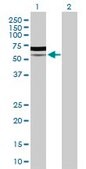 Anti-PIK3R5 antibody produced in rabbit purified immunoglobulin, buffered aqueous solution