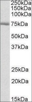 Anti-Crot (C-terminal) antibody produced in goat affinity isolated antibody, buffered aqueous solution