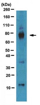 Anti-AKAP 79 Antibody from rabbit, purified by affinity chromatography