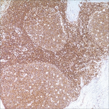 CD45 (LCA) (2B11 &amp; PD7/26) Mouse Monoclonal Antibody