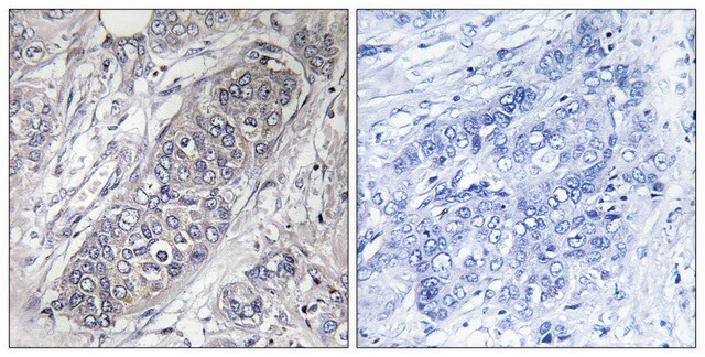 Anti-4E-BP1 antibody produced in rabbit affinity isolated antibody