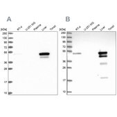 Anti-ABAT antibody produced in rabbit Prestige Antibodies&#174; Powered by Atlas Antibodies, affinity isolated antibody, buffered aqueous glycerol solution