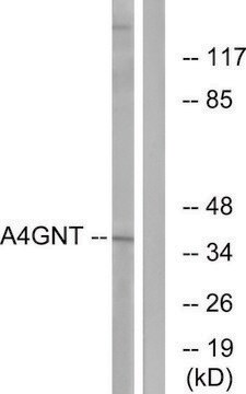 Anti-A4GNT antibody produced in rabbit affinity isolated antibody