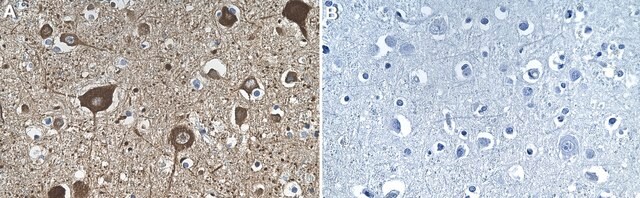 Anti-C9orf72 Long form Antibody, clone 1O5 ZooMAb&#174; Rabbit Monoclonal recombinant, expressed in HEK 293 cells