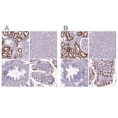 Anti-CUBN antibody produced in rabbit Prestige Antibodies&#174; Powered by Atlas Antibodies, affinity isolated antibody