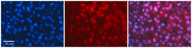 Anti-MBD2 antibody produced in rabbit affinity isolated antibody