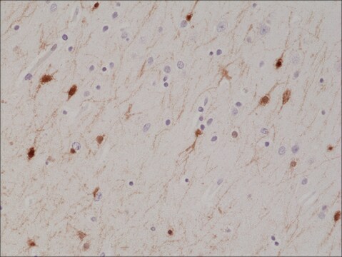 Anti-Calretinin (CALB2) antibody, Rabbit monoclonal recombinant, expressed in HEK 293 cells, clone RM324, purified immunoglobulin