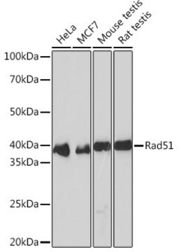 Anti-Rad51 Antibody, clone 5S9B0, Rabbit Monoclonal