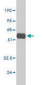 Monoclonal Anti-TNF antibody produced in mouse clone M1-C4, purified immunoglobulin, buffered aqueous solution