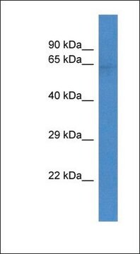 Anti-SLC22A3 antibody produced in rabbit affinity isolated antibody