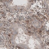 Monoclonal Anti-LAMB1 antibody produced in mouse Prestige Antibodies&#174; Powered by Atlas Antibodies, clone CL2970, purified immunoglobulin, buffered aqueous glycerol solution