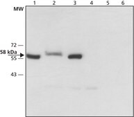 Anti-Monoamine Oxidase B (C-terminal) antibody produced in rabbit affinity isolated antibody, ~1.5&#160;mg/mL, buffered aqueous solution