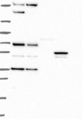 Anti-DPP4 antibody produced in rabbit Prestige Antibodies&#174; Powered by Atlas Antibodies, affinity isolated antibody, buffered aqueous glycerol solution