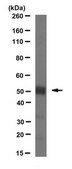 Anti-acetyl-alpha tubulin Antibody, clone 6-11B-1 clone 6-11B-1, from mouse