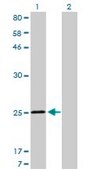 Monoclonal Anti-TNNI3 antibody produced in mouse clone 1E7, purified immunoglobulin, buffered aqueous solution