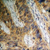 Anti-phospho-Adrenergic Receptor B2 (pSer355+Ser356) antibody produced in rabbit affinity isolated antibody