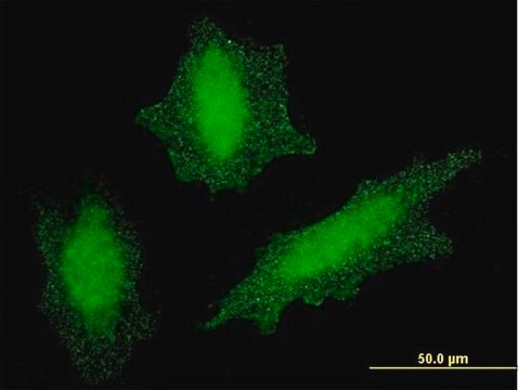 Monoclonal Anti-VHL antibody produced in mouse clone 1G12, purified immunoglobulin, buffered aqueous solution