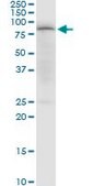 Anti-PDPK1 antibody produced in mouse purified immunoglobulin, buffered aqueous solution