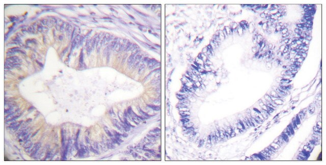 Anti-CBL antibody produced in rabbit affinity isolated antibody