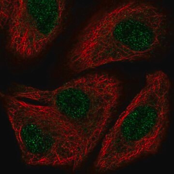 Anti-TOX2 antibody produced in rabbit Prestige Antibodies&#174; Powered by Atlas Antibodies, affinity isolated antibody