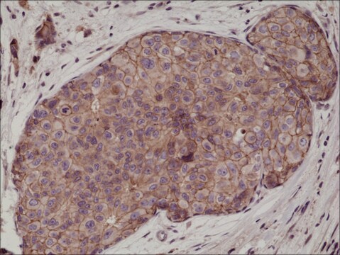 Anti-E-Cadherin (CDH1) antibody, Rabbit monoclonal recombinant, expressed in HEK 293 cells, clone RM244, purified immunoglobulin