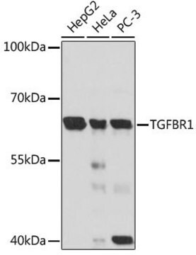 Anti-TGFBR1 antibody produced in rabbit