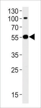 ANTI-PARKIN(N-TERMINAL) antibody produced in rabbit purified immunoglobulin, buffered aqueous solution