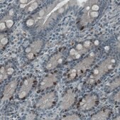Monoclonal Anti-MKI67 antibody produced in mouse Prestige Antibodies&#174; Powered by Atlas Antibodies, clone CL1234, purified immunoglobulin, buffered aqueous glycerol solution